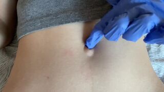 Belly Button and Medical Gloves